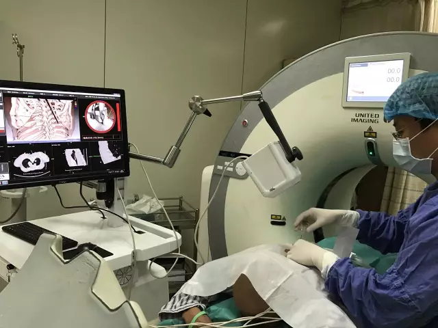 IQQA-Guide三維影像術(shù)中導航系統(tǒng)獲創(chuàng)新醫(yī)械特別審批，推動精準醫(yī)療新發(fā)展